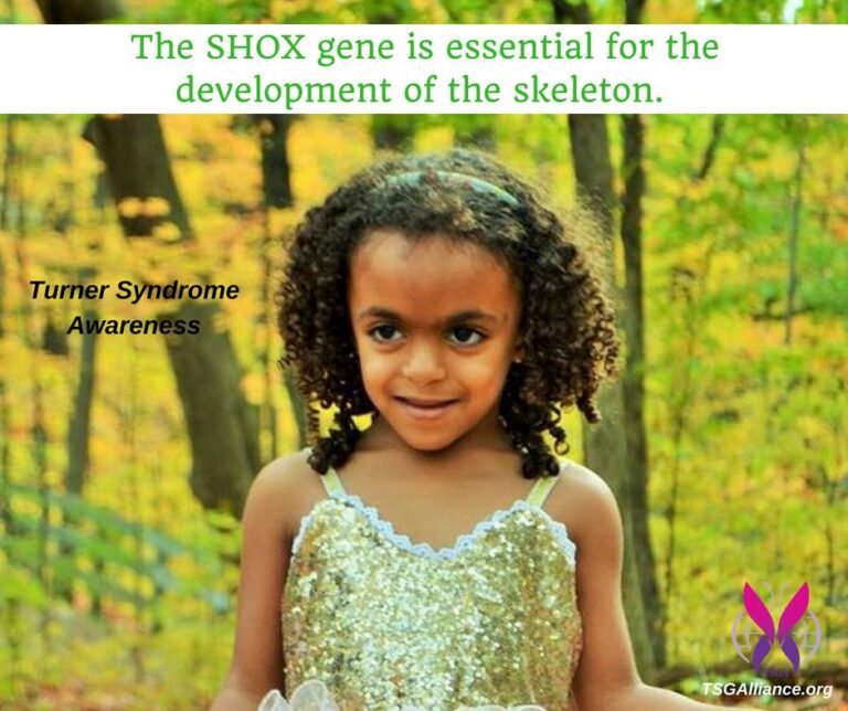Shox gene